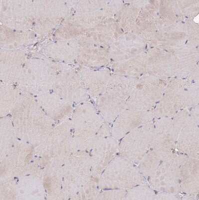 Immunohistochemistry-Paraffin: USP32 Antibody [NBP2-13509]