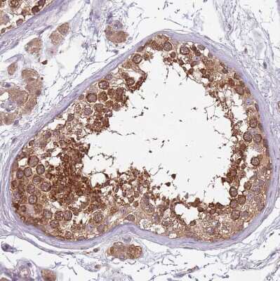 Immunohistochemistry-Paraffin: USP32 Antibody [NBP2-13509]