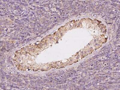 Immunohistochemistry-Paraffin: USP32 Antibody [NBP2-98655]