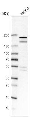 Western Blot: USP32 Antibody [NBP2-13509]