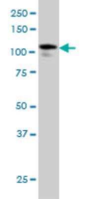 Western Blot: USP33 Antibody (5B5) [H00023032-M01]