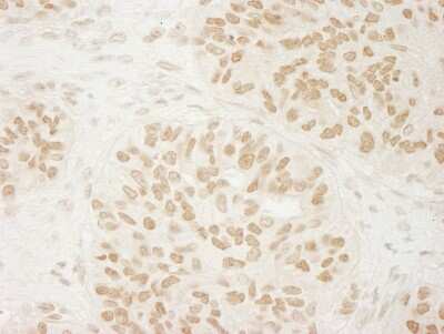 Immunohistochemistry: USP33 Antibody [NB110-40693]