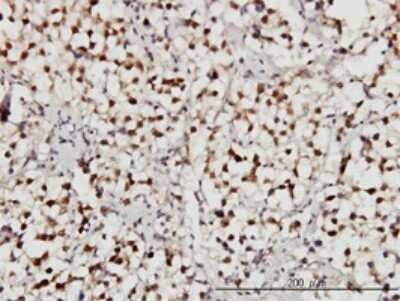 Immunohistochemistry-Paraffin: USP34 Antibody (2E2) [H00009736-M01]