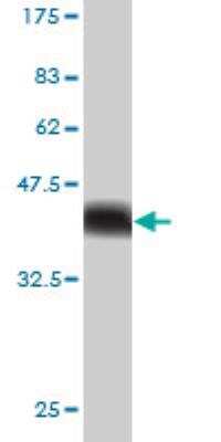 Western Blot: USP34 Antibody (2E2) [H00009736-M01]