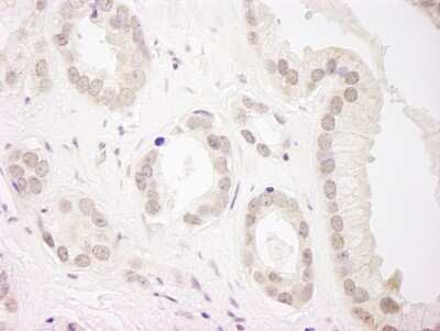 Immunohistochemistry-Paraffin: USP34 Antibody [NB100-2863]