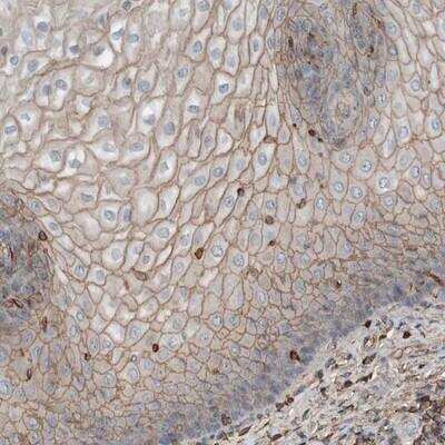 Immunohistochemistry-Paraffin: USP34 Antibody [NBP1-82990]