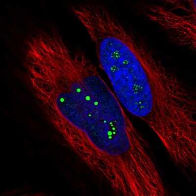 Immunocytochemistry/ Immunofluorescence: USP35 Antibody [NBP2-33743]