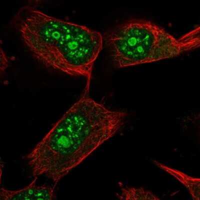 Immunocytochemistry/ Immunofluorescence: USP36 Antibody [NBP2-55536]