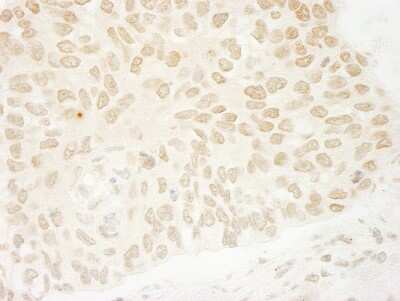 Immunohistochemistry: USP37 Antibody [NB110-40709]