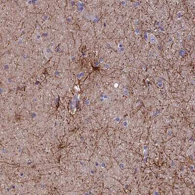 Immunohistochemistry-Paraffin: USP37 Antibody [NBP1-82901]