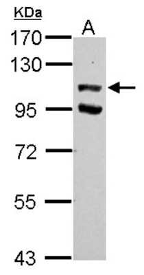 Western Blot: USP37 Antibody [NBP2-20833]