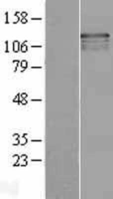 Western Blot: USP37 Overexpression Lysate [NBL1-17660]