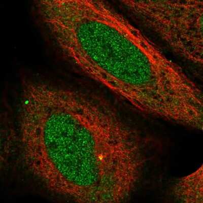 Immunocytochemistry/ Immunofluorescence: USP38 Antibody [NBP2-58097]