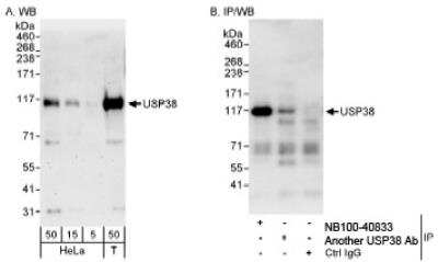 Western Blot: USP38 Antibody [NB100-40833]