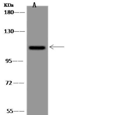 Western Blot: USP38 Antibody [NBP3-06481]