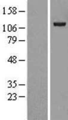 Western Blot: USP38 Overexpression Lysate [NBL1-17661]