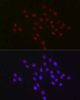Immunocytochemistry/ Immunofluorescence: USP39 Antibody (1S9R9) [NBP3-16119]