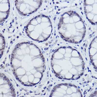 Immunohistochemistry-Paraffin: USP39 Antibody (9E7O2) [NBP3-15474]