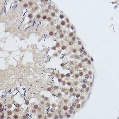 Immunohistochemistry-Paraffin: USP39 Antibody (9E7O2) [NBP3-15474]
