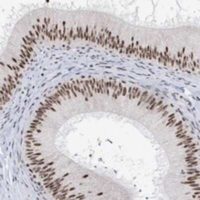 Immunohistochemistry-Paraffin: USP39 Antibody [NBP3-17961]