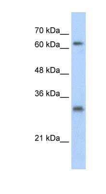 Western Blot: USP39 Antibody [NBP1-80313]