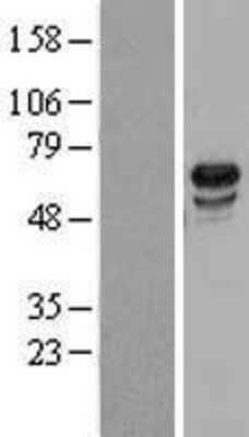 Western Blot: USP39 Overexpression Lysate [NBL1-17662]