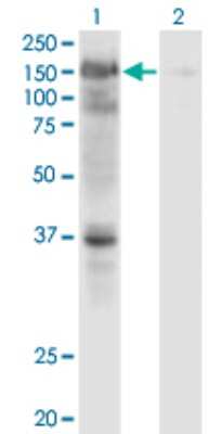 Western Blot: USP4 Antibody (5E12) [H00007375-M01]