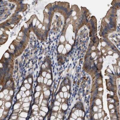 Immunohistochemistry-Paraffin: USP4 Antibody [NBP1-86876]