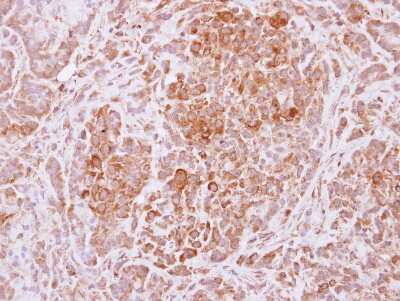 Immunohistochemistry-Paraffin: USP4 Antibody [NBP2-20834]