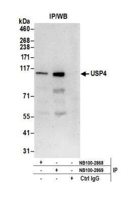Immunoprecipitation: USP4 Antibody [NB100-2869]