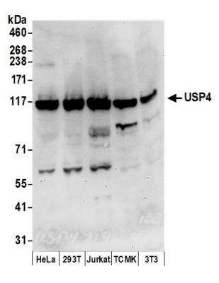 Western Blot: USP4 Antibody [NB100-2869]