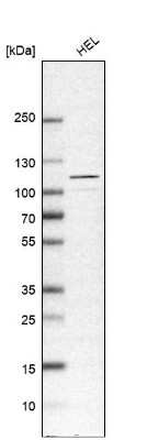 Western Blot: USP4 Antibody [NBP1-86876]