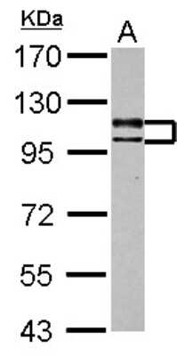 Western Blot: USP4 Antibody [NBP2-20834]