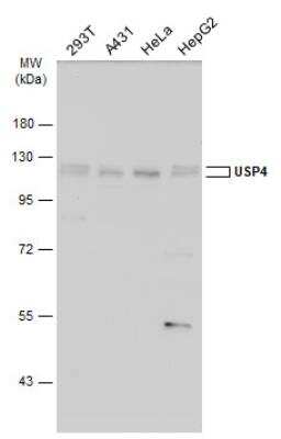 Western Blot: USP4 Antibody [NBP2-20834]