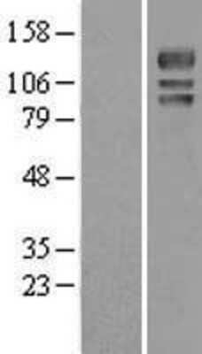 Western Blot: USP4 Overexpression Lysate [NBL1-17663]