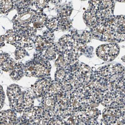 Immunohistochemistry-Paraffin: USP40 Antibody [NBP1-90426]