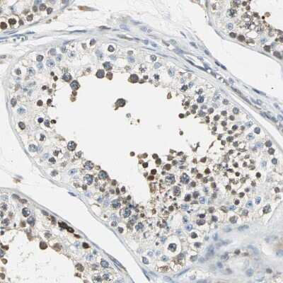 Immunohistochemistry-Paraffin: USP40 Antibody [NBP1-90426]