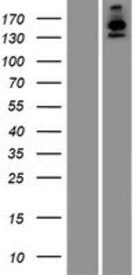 Western Blot: USP40 Overexpression Lysate [NBP2-06843]