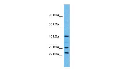 Western Blot: USP41 Antibody [NBP3-09906]