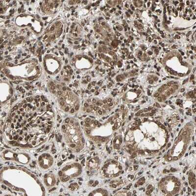 Immunohistochemistry-Paraffin: USP42 Antibody [NBP1-83715]