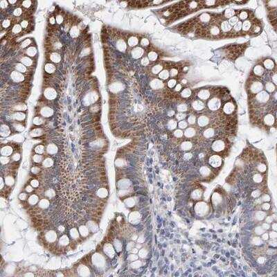 Immunohistochemistry-Paraffin: USP43 Antibody [NBP1-82040]