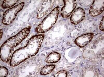 Immunohistochemistry: USP44 Antibody (OTI1D1) [NBP2-46306]