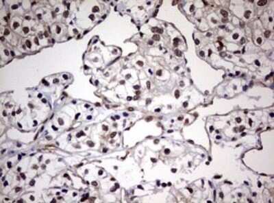 Immunohistochemistry: USP44 Antibody (OTI1D1) [NBP2-46306]