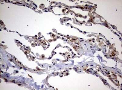 Immunohistochemistry: USP44 Antibody (OTI1D1) [NBP2-46306]