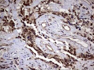 Immunohistochemistry: USP44 Antibody (OTI1D1) [NBP2-46306]