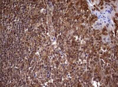 Immunohistochemistry: USP44 Antibody (OTI1D1) [NBP2-46306]