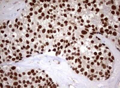 Immunohistochemistry: USP44 Antibody (OTI1D1) - Azide and BSA Free [NBP2-74811]
