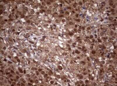 Immunohistochemistry: USP44 Antibody (OTI1D1) - Azide and BSA Free [NBP2-74811]