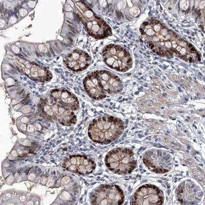 Immunohistochemistry-Paraffin: USP45 Antibody [NBP1-81200]