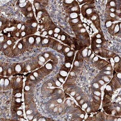 Immunohistochemistry-Paraffin: USP45 Antibody [NBP1-81201]